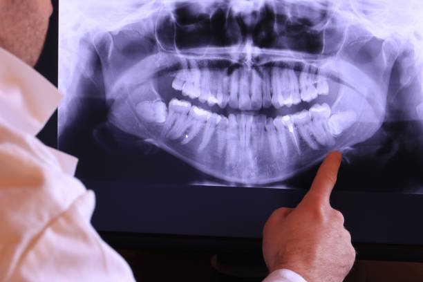 Best Tooth Infection Emergency Dentist  in Suncoast Estates, FL